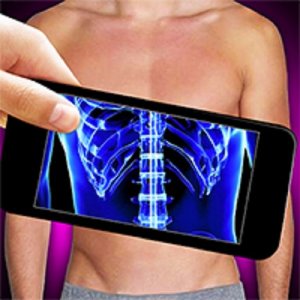 Funny Bone Surgery Online Game